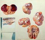 Aquarelles d'ovaires et coupes d'ovaire de jument montrant des follicules et des corps jaunes