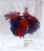 Coeur et vaisseaux pulmonaires de l'agneau, injection corrosion. Inclusion