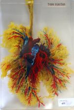 Injection-corrosion du coeur, des vaisseaux pulmonaires et du système bronchique de l'agneau. Inclus [...]
