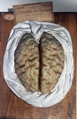 Cerveau de l'homme, face supérieure.
