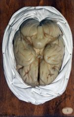 Cerveau de l'homme, face inférieure.