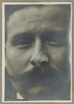 [Portrait d'un homme de face après pose de prothèse nasale.]