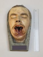 [Moulage d'un visage d'homme traumatisé de la face présentant une plaie béante du maxillaire inférie [...]