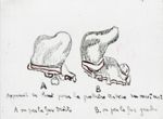 [Schéma de l'appareil du Dr Pont pour la prothèse tardive du maxillaire supérieur.]