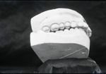 [Moulages dentaires. Maxillaires inférieur et supérieur. Présentés de profil, en position fermée, av [...]