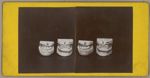 [Deux clichés identiques collés sur carton, montrant chacun deux paires de moulages dentaires présen [...]