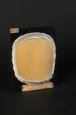 Lichen scrofulosorum, forme acuminée (Inv. 1922). Lichen pilaire, en plaques : syn., lichen des lymp [...]