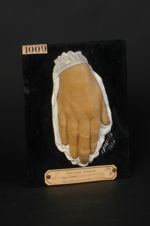 Lésion indéterminée des ongles (Inv. 1922). Eczéma primitif des ongles