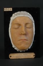Adénomes sébacés symétriques de la face, type Pringle (Inv. 1922). Homme âgé de 26 ans, cultivateur