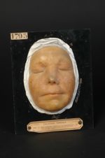 Lupus tuberculeux vulgaire de la face, repullulation des tubercules dans la cicatrice. Femme âgée de [...]