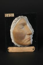 Lupus pernio (Inv. 1923). Femme âgée de 41 ans, ménagère (Obs. sous le titre Lupus érythémateux exan [...]
