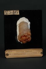 Épithéliome spino-cellulaire (Inv. 1922) de la verge. Homme âgé de 45 ans