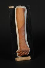 Erythro-kératodermie verruqueuse, en nappes, symétrique et progressive, congénitale. Homme âgé de 15 [...]