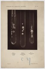 Annales de l'Institut Pasteur - Planche XI -  Fig. 1 Achorion en godets (42e jour) ; Fig. 2 Achorion [...]