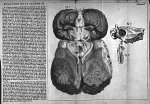 Base du cerveau dépouillé de tous ses vaisseaux - Traité de l'organe de l'ouïe