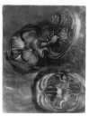 Anatomie de la tête, en tableaux imprimés qui représentent au naturel le cerveau sous différentes co [...]