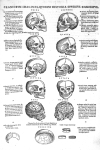 Craniorum imagines - Chirurgiae ... libri septem