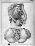 [Trajet et distribution de l'artère hypogastrique chez la femme, trajet de l'artère honteuse commune [...]