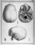 [Crâne d'un homme de 40 ans, os wormiens désarticulés] - Manuel d'anatomie descriptive du corps huma [...]