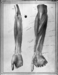 [Muscles de la région antérieure et superficielle de l'avant-bras d'un homme de 36 ans, muscle cubit [...]