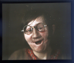 [Portrait de femme de face après pose de prothèse oculo-faciale.]