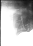 [Radiographie. Maxillaires supérieur et inférieur de profil, bouche fermée.]