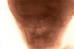 [Radiographie de la face.]