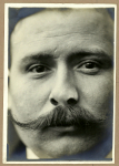 [Portrait d'un homme de face après pose de prothèse nasale.]