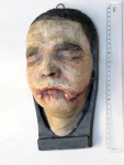 [Moulage d'un visage d'homme traumatisé de la face présentant une plaie du maxillaire inférieur avec [...]