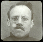 [Plaque photographique de projection. Portrait de face après pose de prothèse nasale et lunettes de  [...]