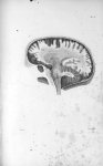 Pl. X. Crâne scié du côté gauche (cerveau de femme) - Anatomie et physiologie du système nerveux en  [...]