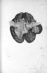 Pl. XVII. Cerveau posé sur sa face supérieure - Anatomie et physiologie du système nerveux en généra [...]