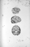 Pl. XXXIV. Fig. 1. Cerveau du singe (Rhésus-patas) / Fig. 2. Cerveau de l'orang-outang, vu de côté / [...]