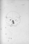 Pl. LXXVIII. Crâne de la fille Bouhours, avec un très-grand développement des organes qui disposent  [...]