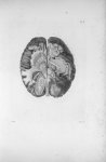 Pl. V. Représentation du cervelet et d'une partie de la base du cerveau - Anatomie et physiologie du [...]