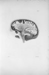 Pl. X. Crâne scié du côté gauche (cerveau de femme) - Anatomie et physiologie du système nerveux en  [...]