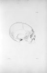 Pl. XXVI. Crâne d'un jeune homme de quinze ans, incomplètement idiot, voleur incorrigible - Anatomie [...]