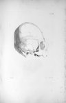 Pl. XXXII. Crâne, dont le diamètre d'un temporal à l'autre est plus considérable que du frontal à l' [...]