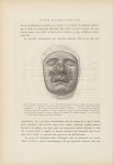 Lupus vulgaire du centre de la face - Le musée de l'hôpital Saint-Louis : iconographie des maladies  [...]