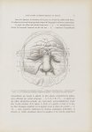 Fig. 1. Couperose hypertrophique - Le musée de l'hôpital Saint-Louis : iconographie des maladies cut [...]