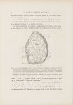 Fig. 1. Syphilide papulo-squameuse circinée - Le musée de l'hôpital Saint-Louis : iconographie des m [...]