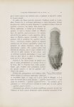 Fig. 2. Plaques syphilitiques de la peau à forme squameuse - Le musée de l'hôpital Saint-Louis : ico [...]