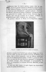 Fig. 22. Cyphose au cours de la maladie de Parkinson - Titres et travaux scientifiques. Décembre 190 [...]