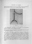 Fig. 29. Appareil à extension pour les fractures de l'humérus - Exposé des travaux scientifiques