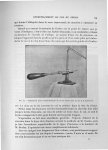 Fig. 34. Instrument pour l'enchevillement du col du fémur avec la vis et le tourne-vis - Exposé des  [...]