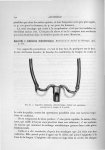 Fig. 67. Appareil à inhalation chloroformique, destiné aux opérations portant sur la langue et le pa [...]