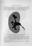 Fig. 91. Radiographie d'un bassinet injecté - Exposé des travaux scientifiques