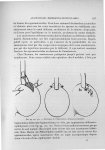Fig. 99, 100, 101. Technique de l'implantation déférento-testiculaire - Exposé des travaux scientifi [...]