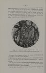 Fig. 31. - Epithélioma malpighien du goudron chez la souris - Titres et travaux scientifiques