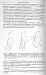 Fig. 141. Modifications de la forme de la partie postérieure du bras suivant l'état physiologique du [...]